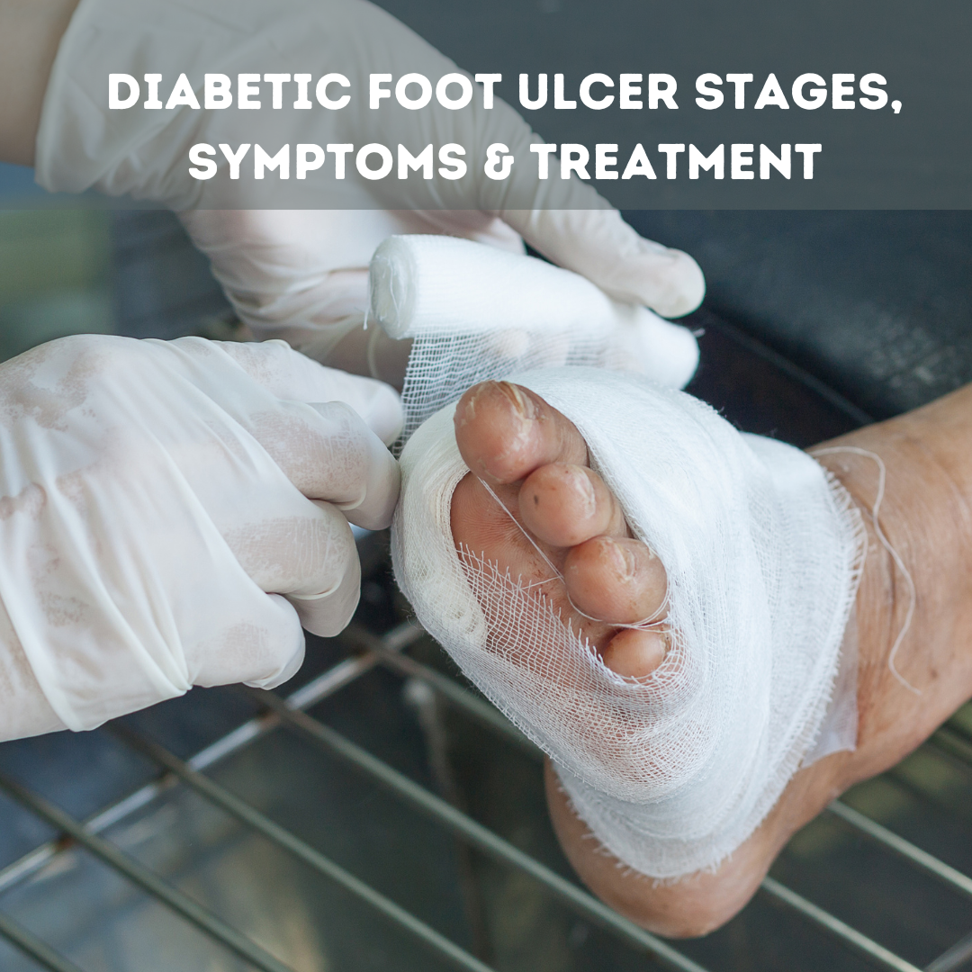 Diabetic foot ulcer stages Causes, symptoms& treatment