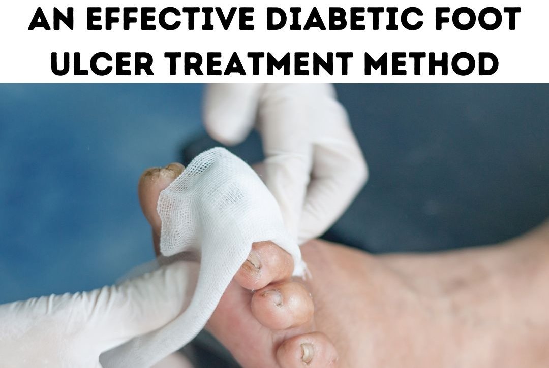 diabetic foot ulcer treatment methods