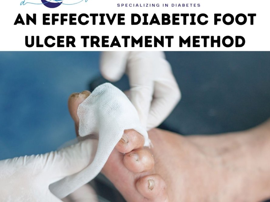 diabetic foot ulcer treatment methods