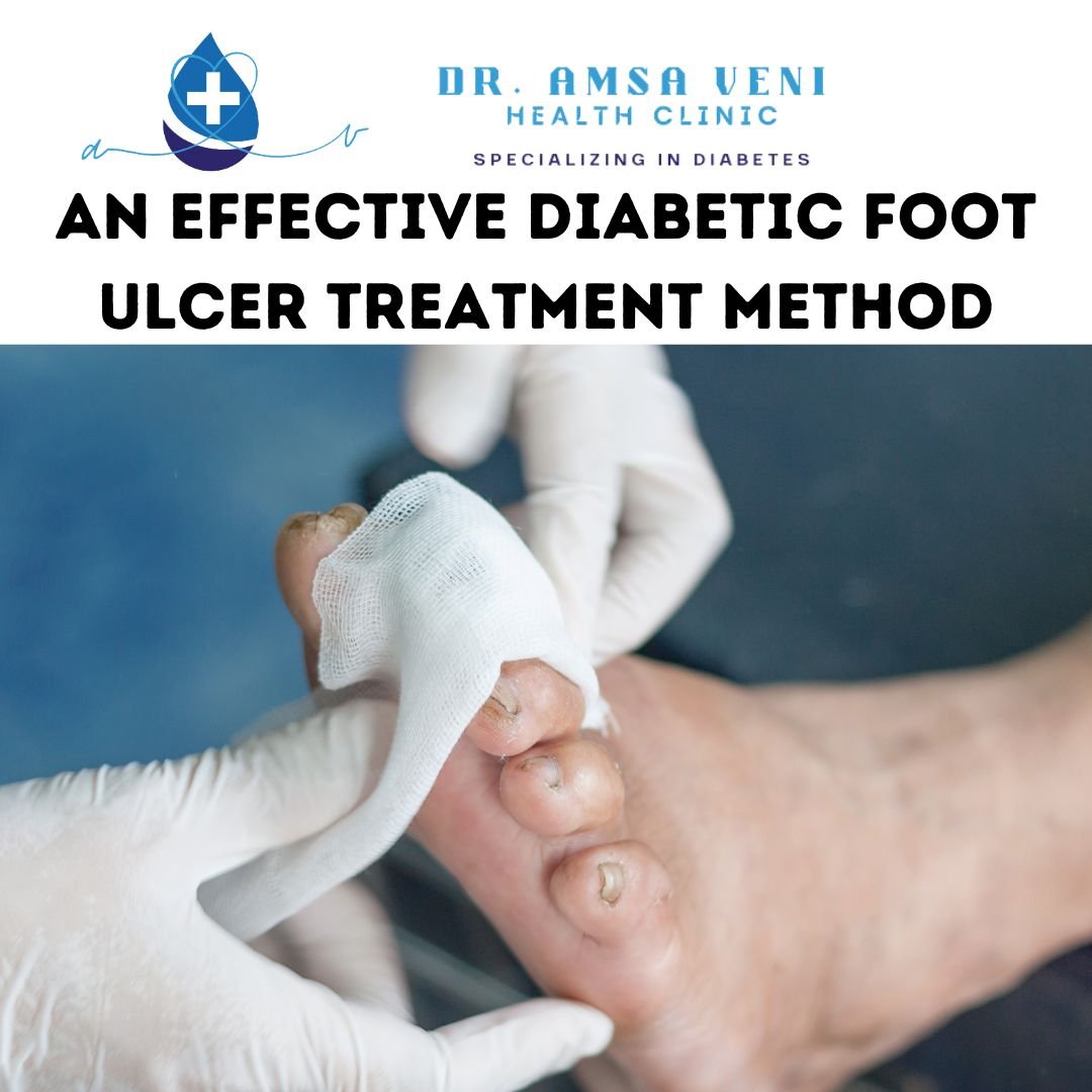 diabetic foot ulcer treatment methods