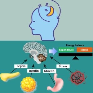 Sleep Deprivation and Appetite Hormones