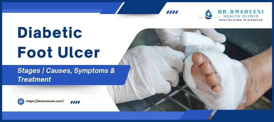 Diabetic Foot Ulcer Stages, Causes, Symptoms & Treatment