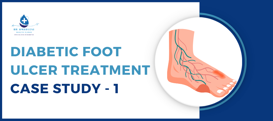 Diabetic Foot Ulcer Treatment Case Study