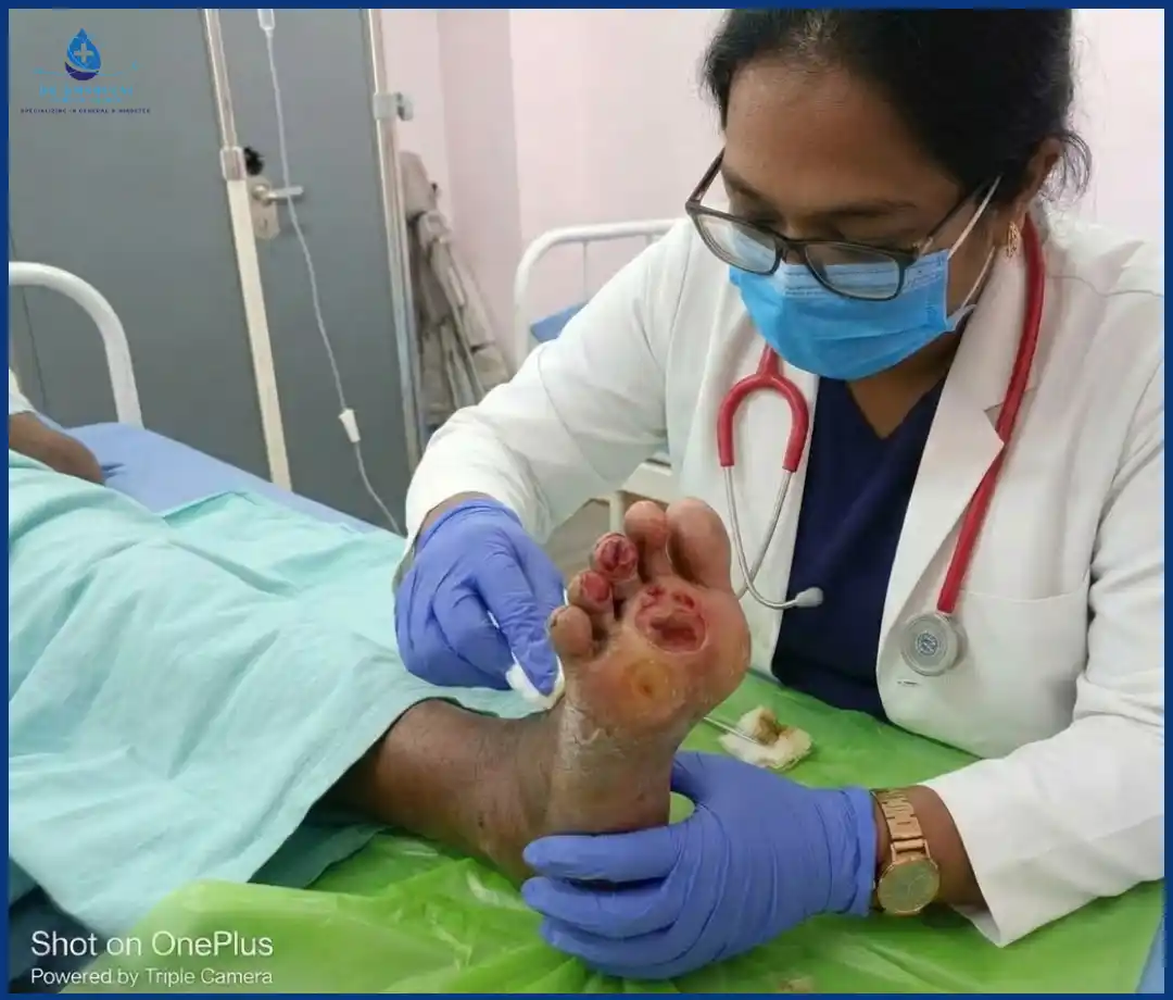 Diabetic Foot Ulcer Treatment Wound Care Img1