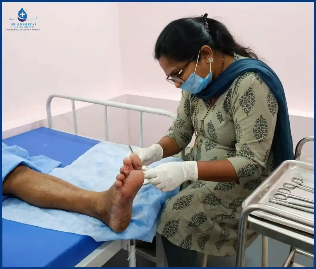 Diabetic Foot Ulcer Treatment Wound Care Img3