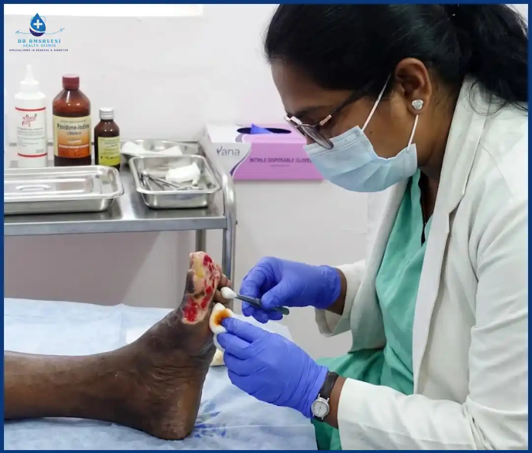 Diabetic Foot Ulcer Treatment Wound Care Img5