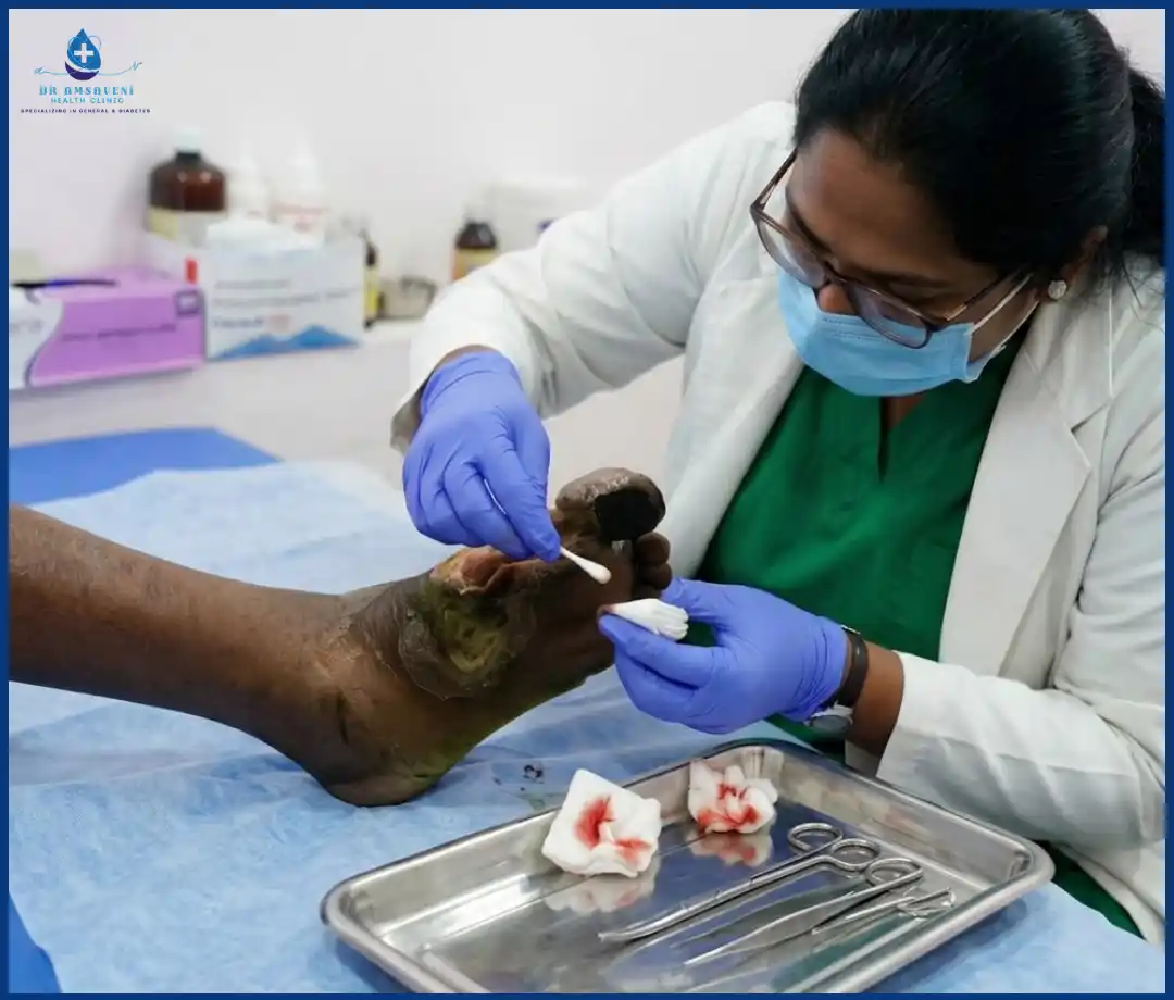 Diabetic Wound Dressing Img4