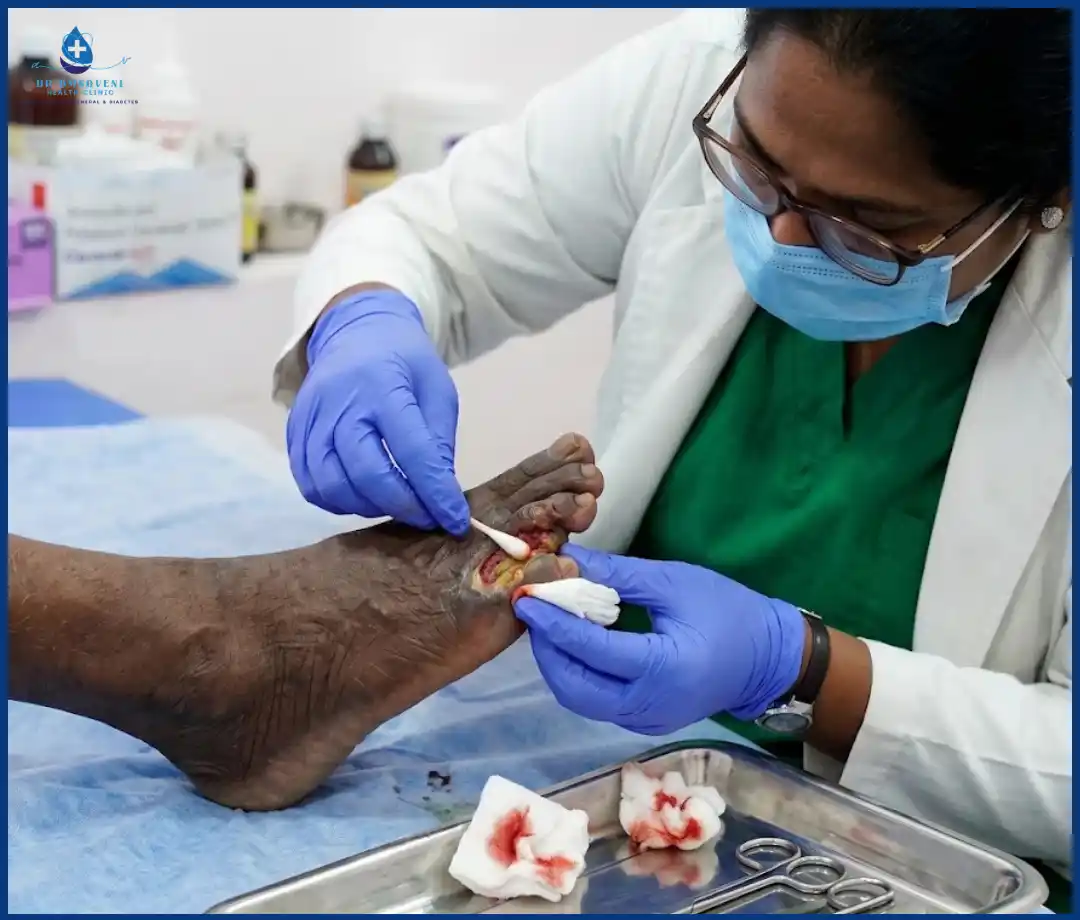 Diabetic Wound Dressing Img6