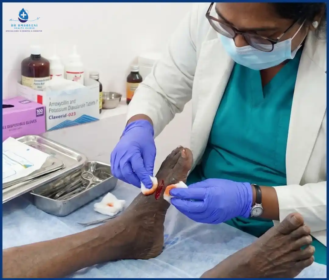 Diabetic Wound Dressing Img7