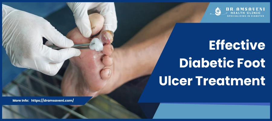 Effective Diabetic Foot Ulcer Treatment
