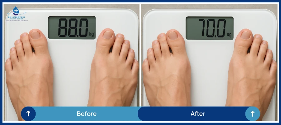 Weight Loss Treatment